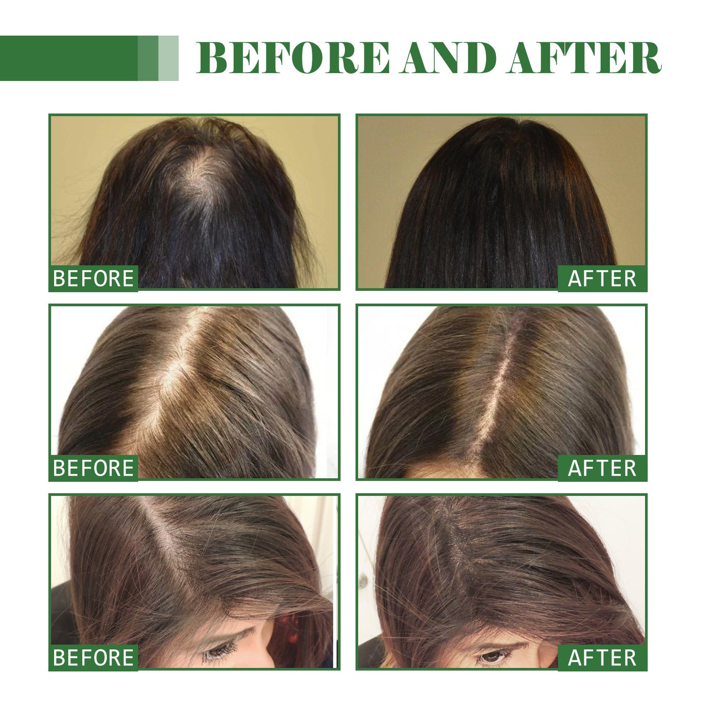 Dense Hair Oil Moisturizing Soft Hair Repair