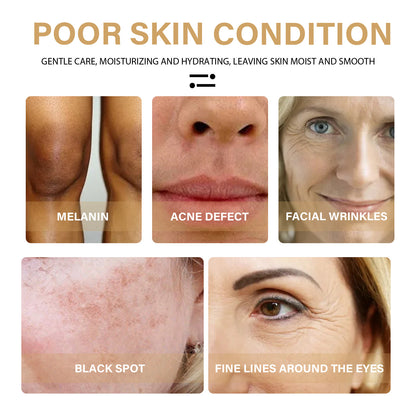 Turmeric Dark Spot Correction Face Care Spot Moisturizing And Repairing Skin Tone Serum
